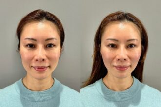 アルテミスリフト アルテミスリフト