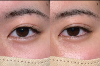 二重埋没 二重埋没