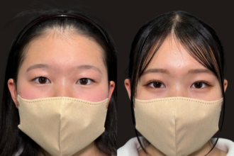 PRISM 1day二重埋没