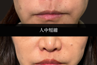 人中短縮