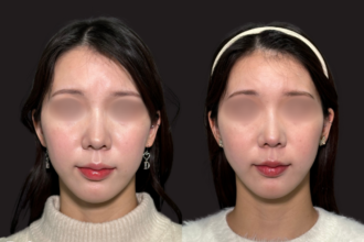 ウルトラソフト