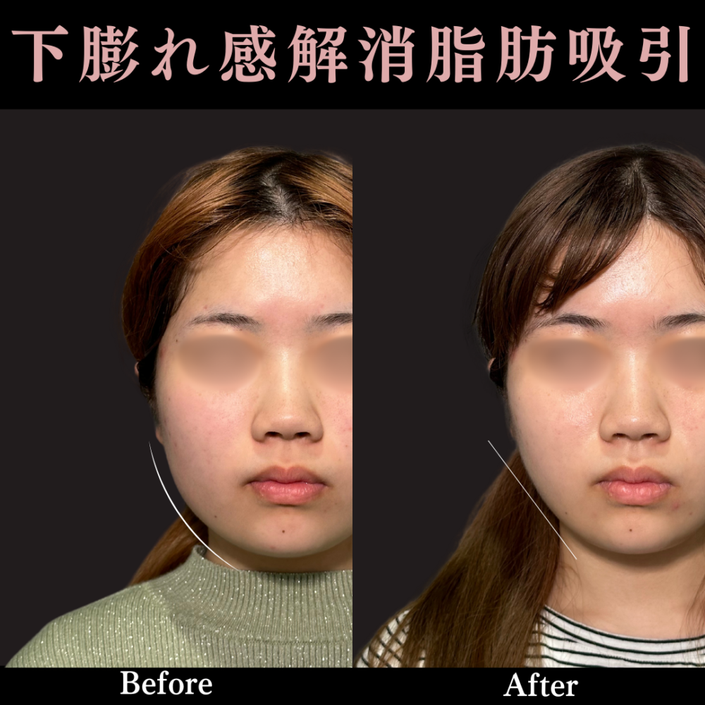 ムダな脂肪をメラメラ燃やす本 １カ月でやせる驚異のシェイプアップ法/講談社/伊藤雄康（新書） 日体大教授が教える 「脂肪燃焼」食 運動0でお腹が凹む! | 岡田