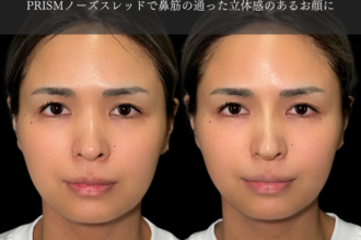PRISMノーズスレッド