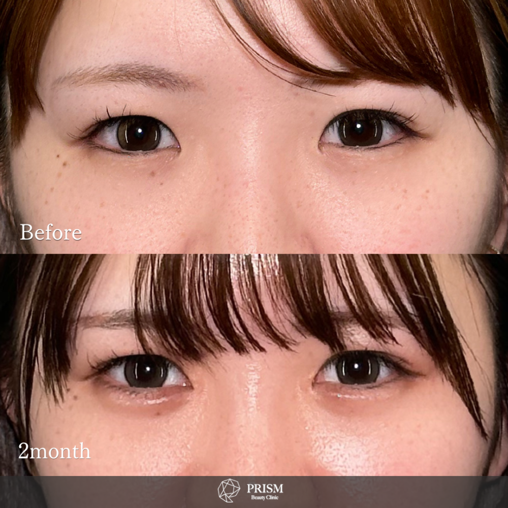 マミー様　3点まとめ Amazon.co.jp: 絶縁被覆付閉端接続子【250個セット】コネクター
