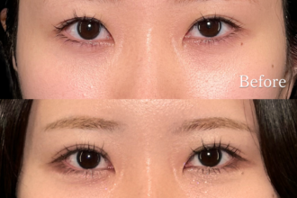 PRISM 1day二重埋没 ナチュラル 4点留め