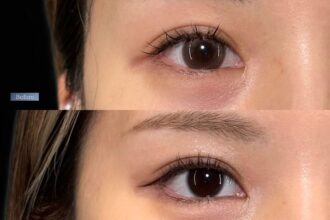 目尻切開+たれ目形成(グラマラスライン) 裏側切開 パーフェクト 目尻切開+たれ目形成(グラマラスライン) 裏側切開 パーフェクト