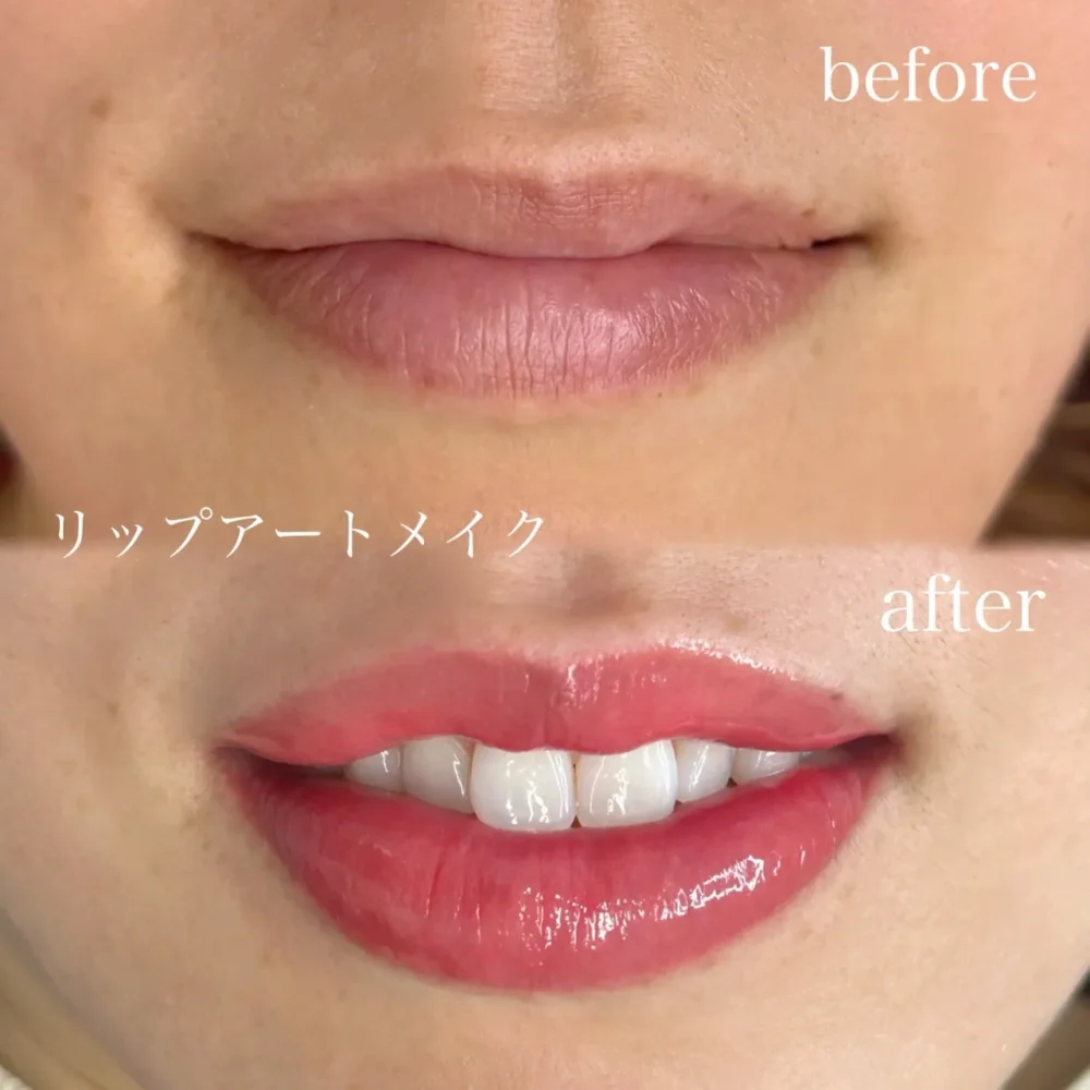 アートメイク（リップ）